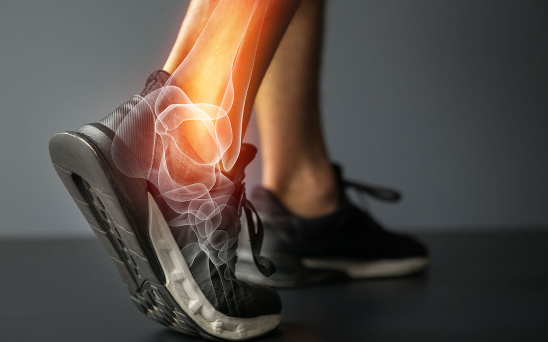 The Genetic Link to Ankle Injuries — And What to Do About It